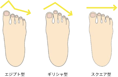 足形タイプ