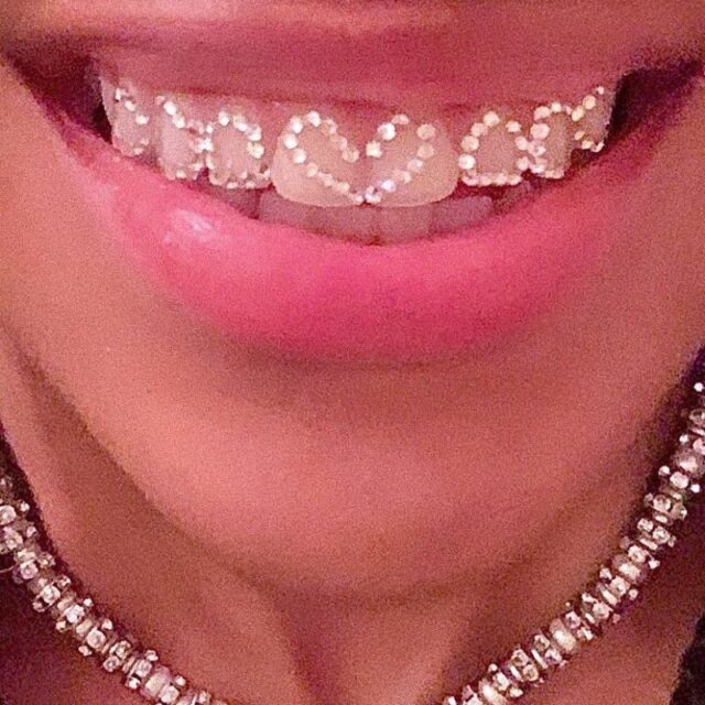 歯をデコる？！【トゥースジェム（ティースジュエリー）】が新たなトレンド！やり方や体験談もレポ