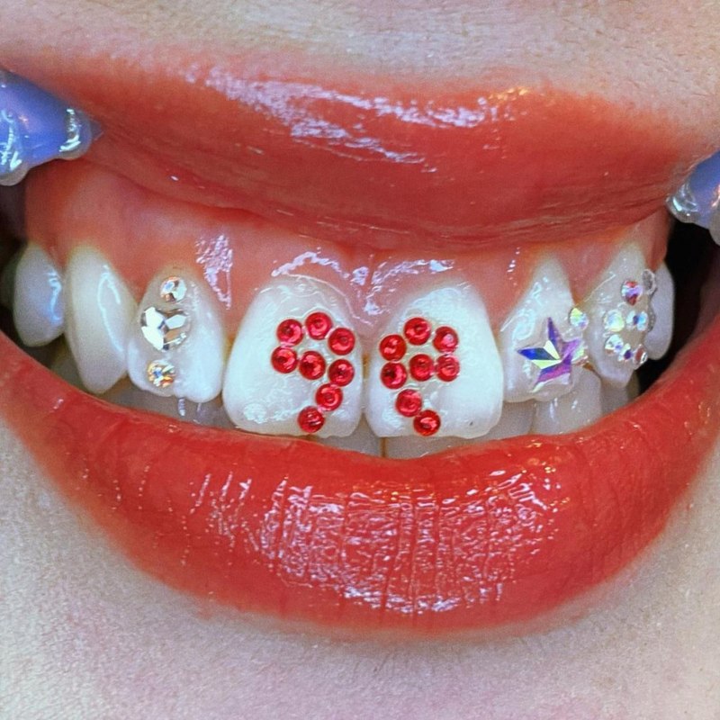 トゥースジェム ティースジュエリー tooth-gem-13