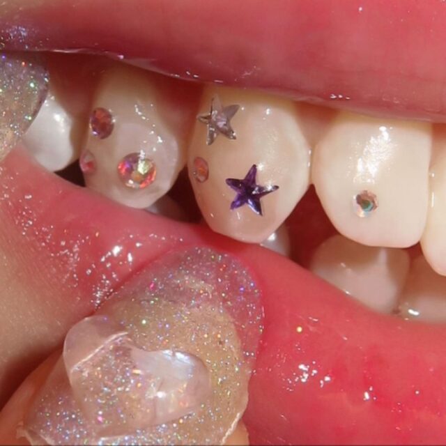 歯をデコる？！【トゥースジェム（ティースジュエリー）】が新たなトレンド！やり方や体験談もレポ